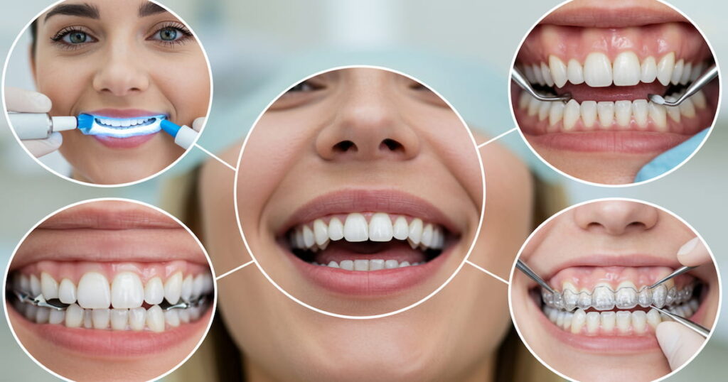 Dental Restorations & Aesthetic Fillings thumbnail
