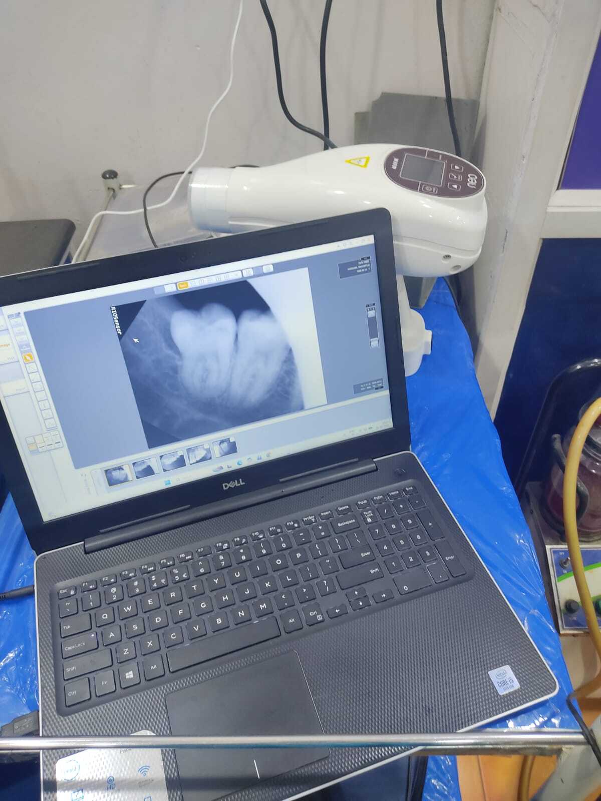 Dental equipment
